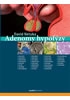 Detail titulu Adenomy hypofýzy